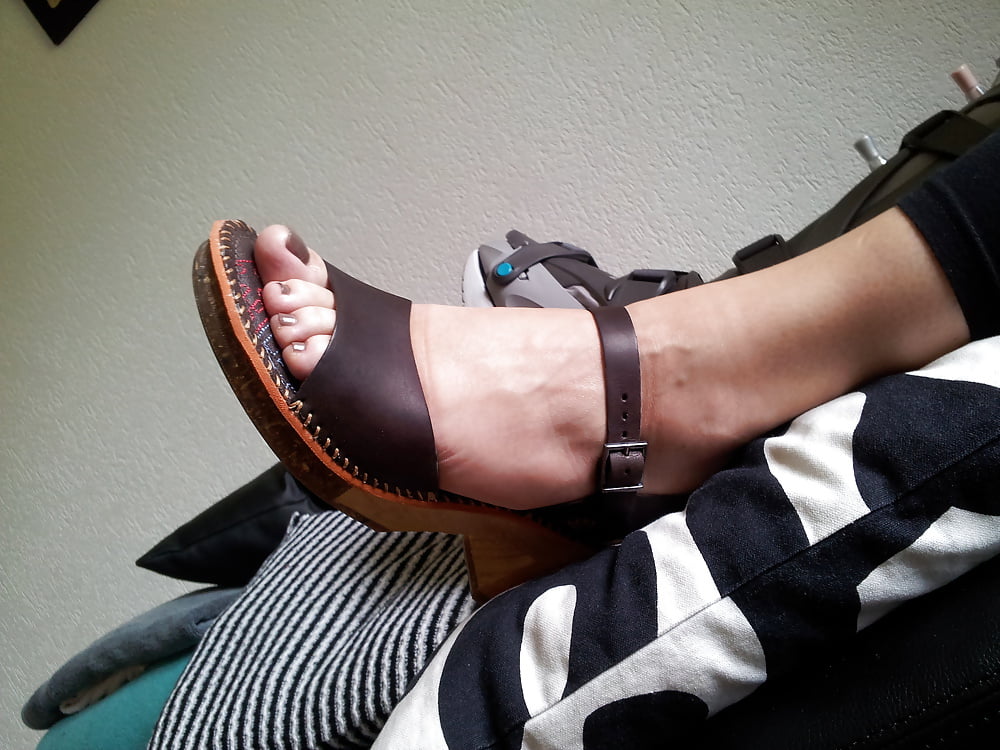 Broken foot but sexy woman