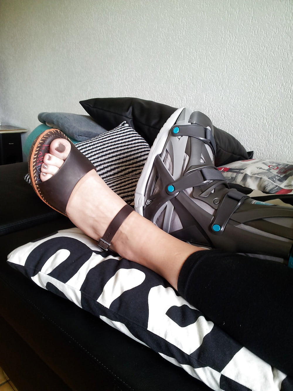 Broken foot but sexy woman