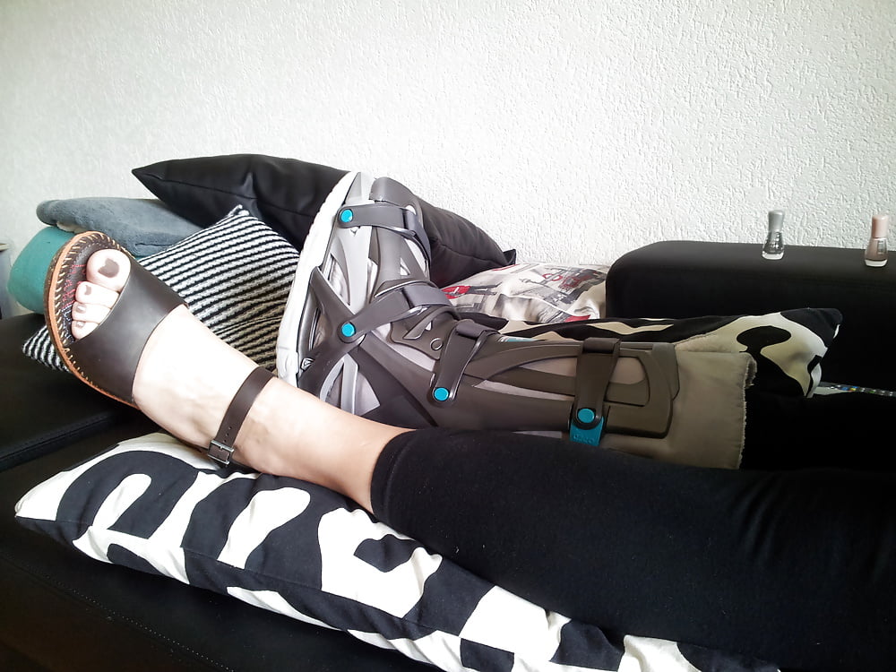 Broken foot but sexy woman