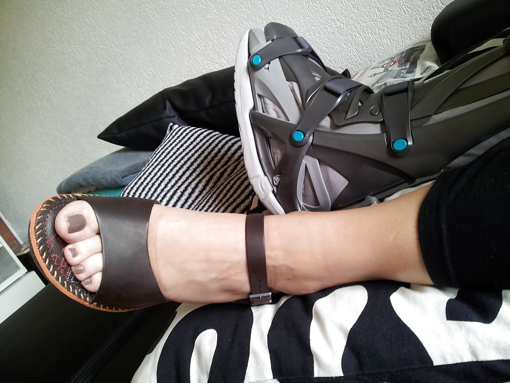 Broken foot but sexy woman